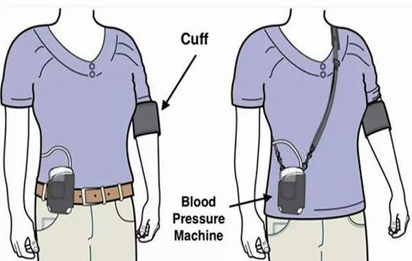智能动态血压监测设备在心血管疾病管理中的重要性