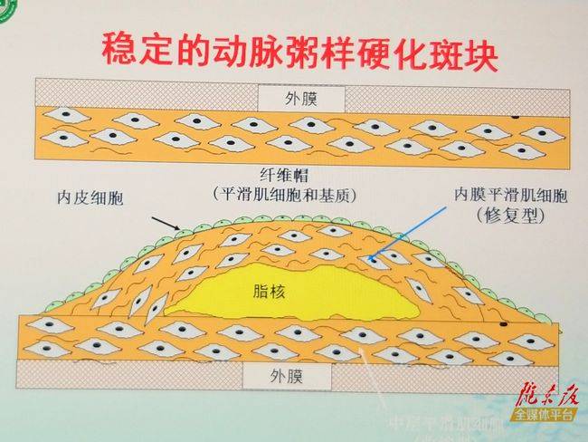 良好心态在慢性病预防中的关键作用