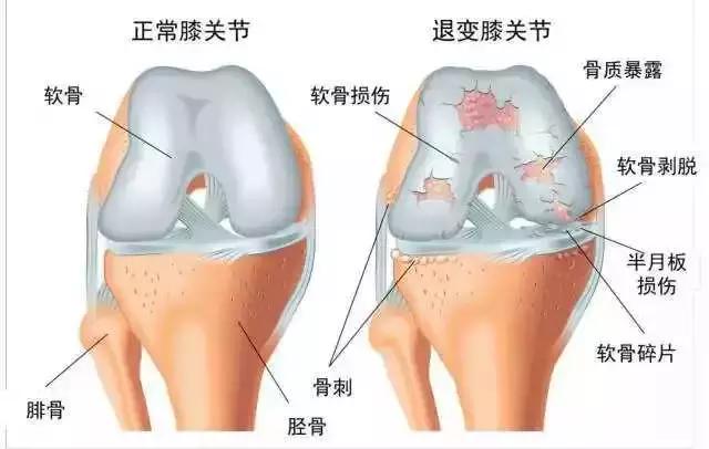 舒缓运动与关节灵活度的提升之道